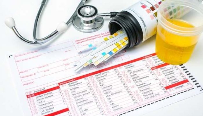 Warganet Setuju Semua Anggota DPRD Sumenep Dites Urine